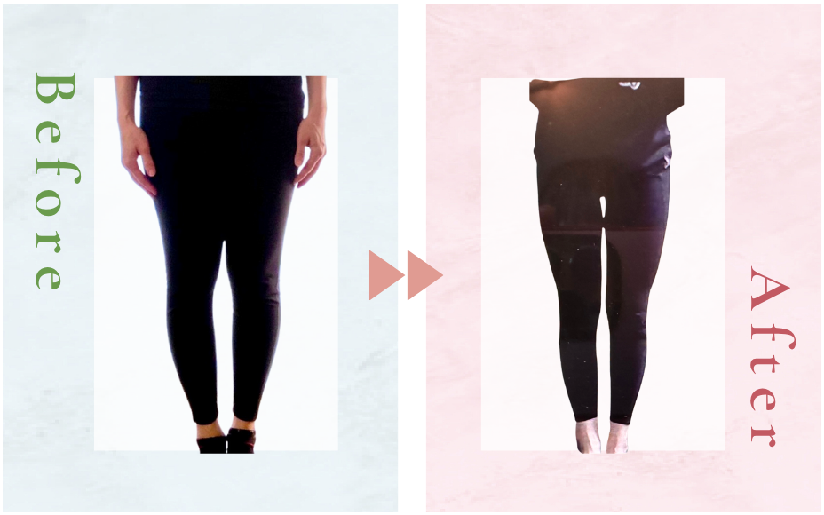 くみこさんビフォーアフター