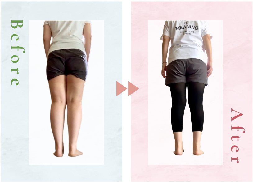 なおみさんビフォーアフター